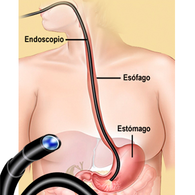 endoscopio